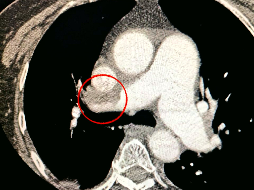 16423 image for slide