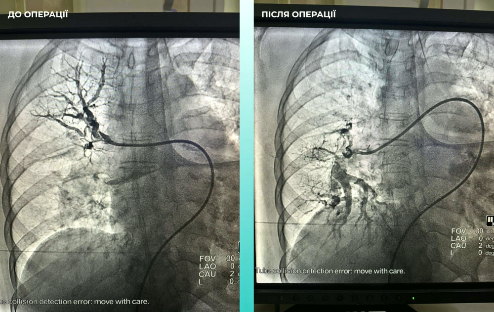 16424 image for slide