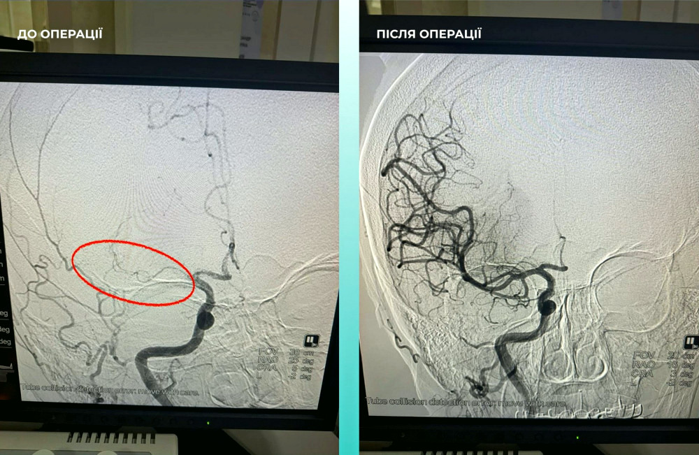 16426 image for slide